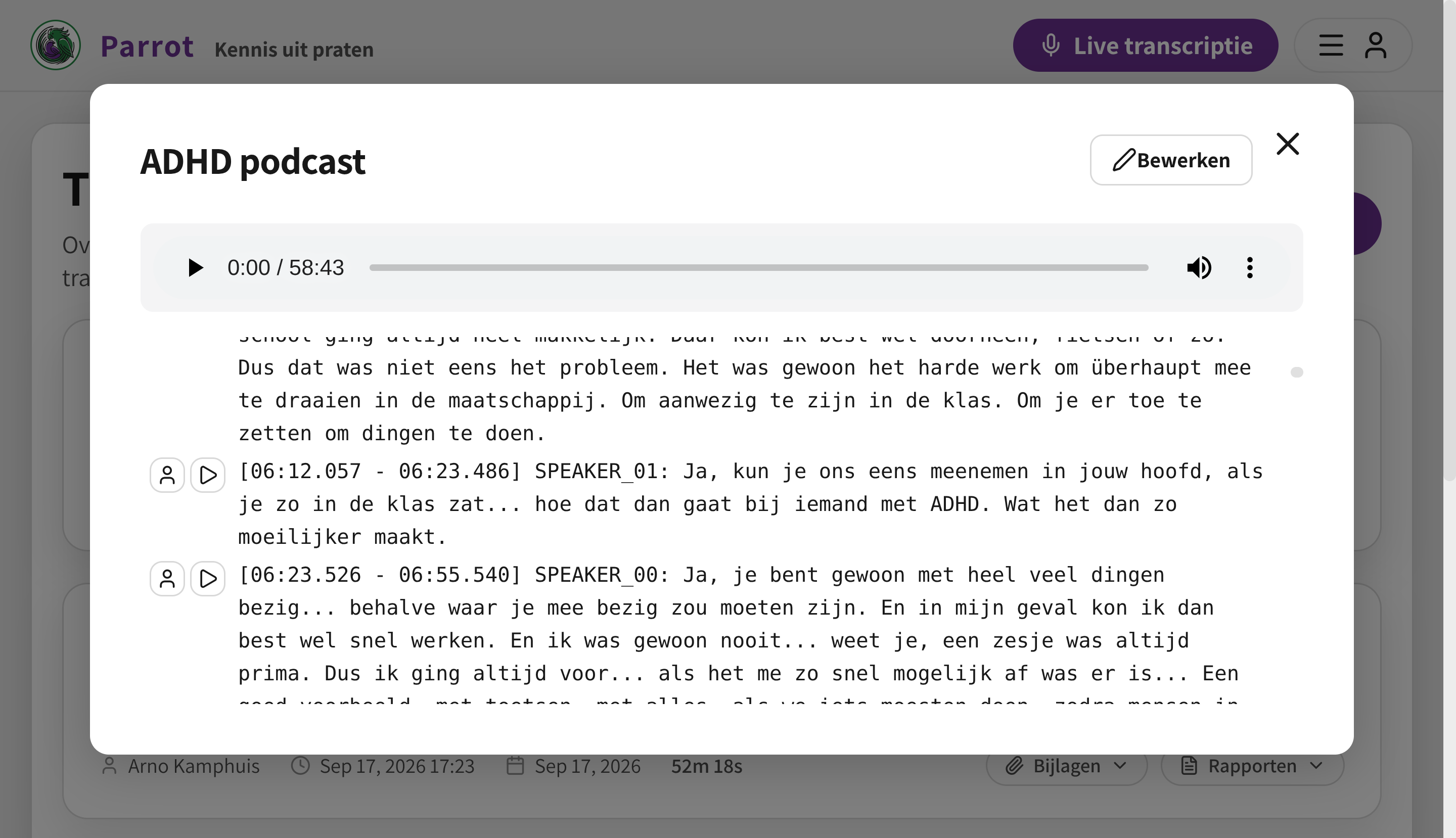 Transcription UI